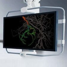 embo-assist-ai-tile-en