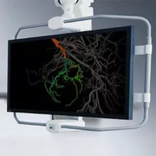 embo-assist-mobile