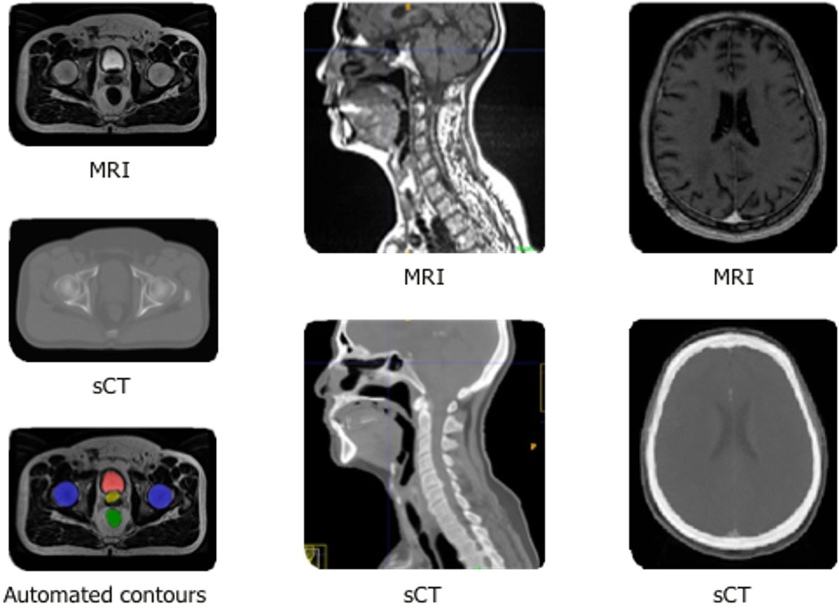 Enabling Radiation Oncology Treatment Planning with Advanced Imaging Techniques and AI-based Tools