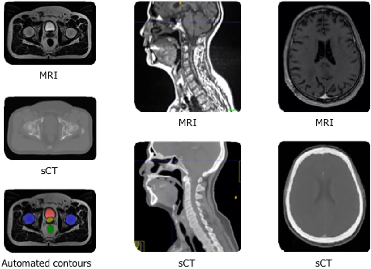 Enabling Radiation Oncology Treatment Planning with Advanced Imaging Techniques and AI-based Tools