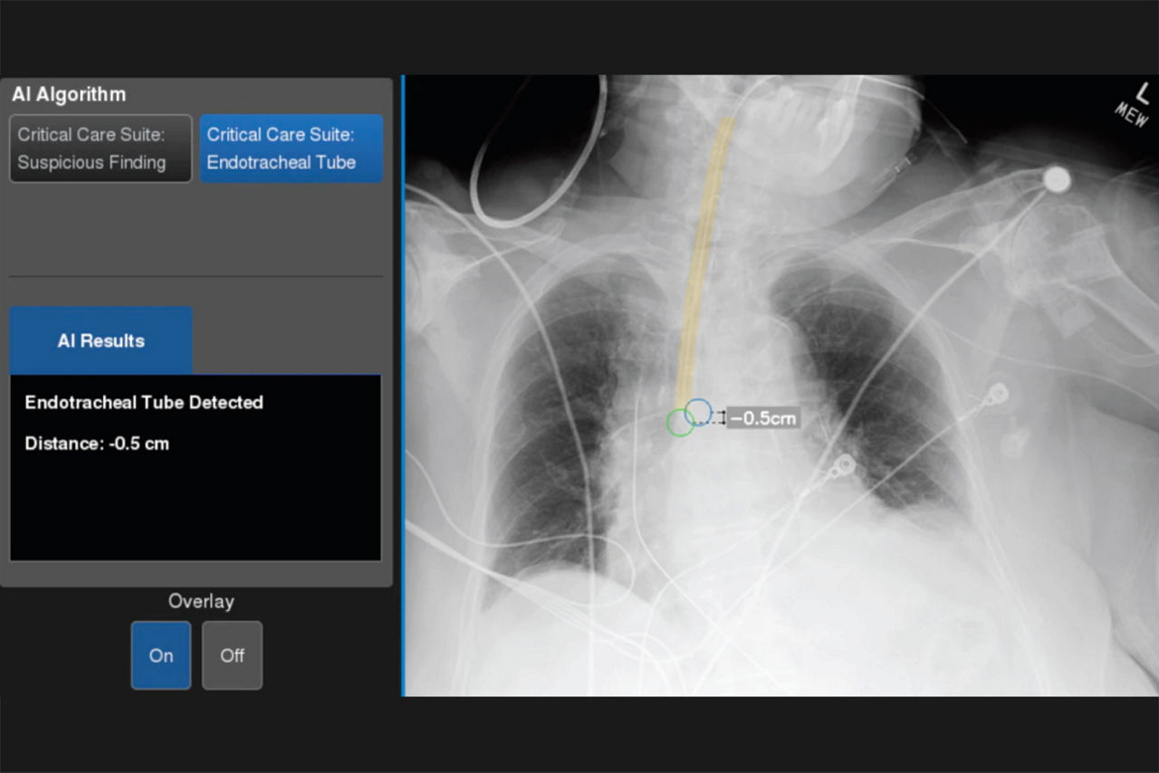 endotracheal-tube-positioning-desktop
