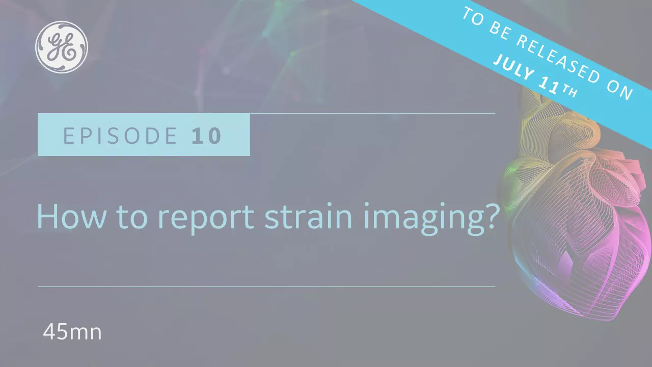 Episode 10-v2