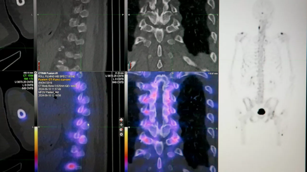 erasme-aurora-partnering-with-ge-healthcare-video