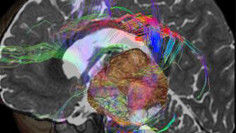 visualização avançada brain view plus.
