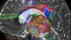 visualização avançada brain view plus.