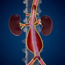 evar-assist-2-tile-en