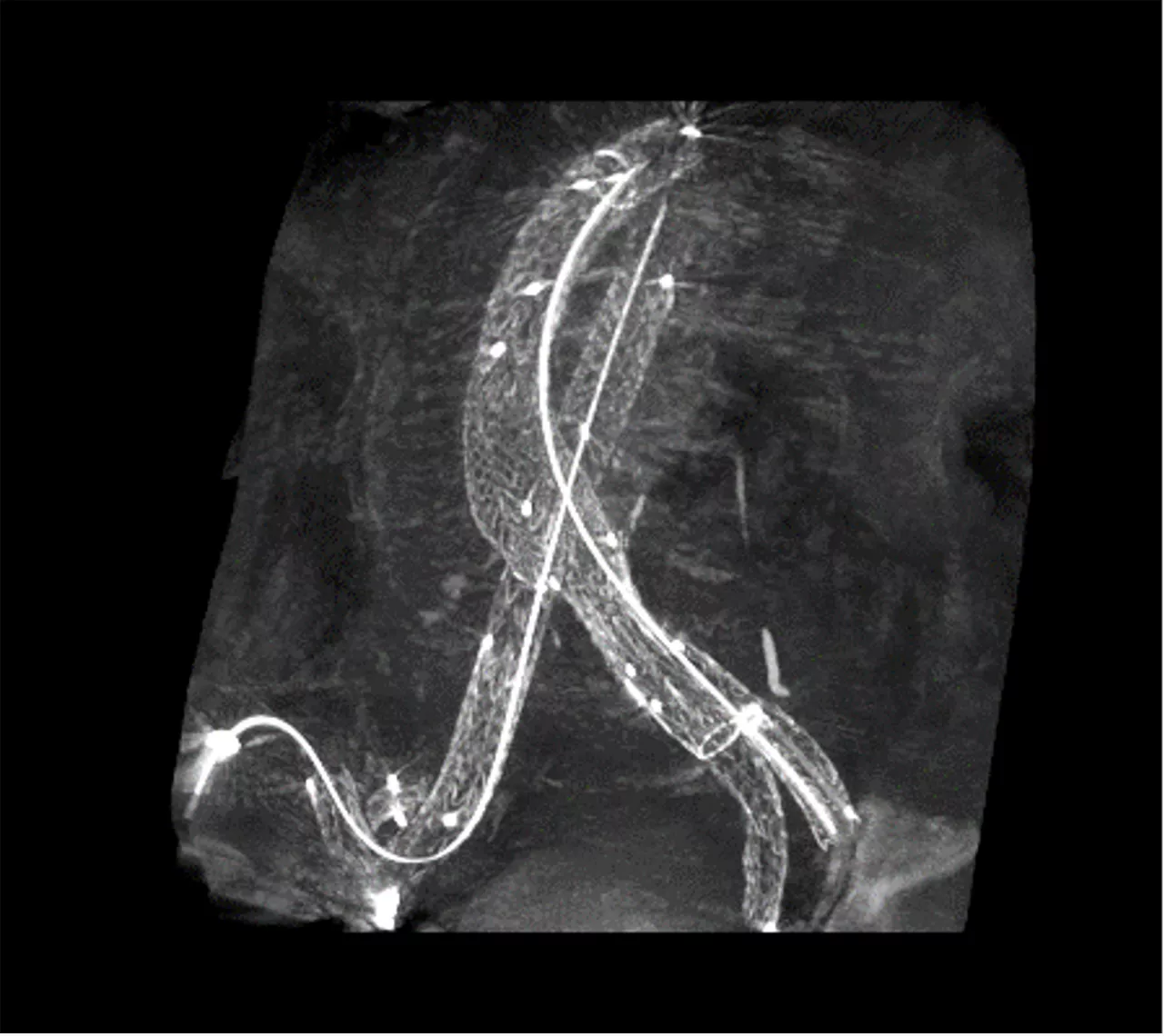 evar1-mip-1