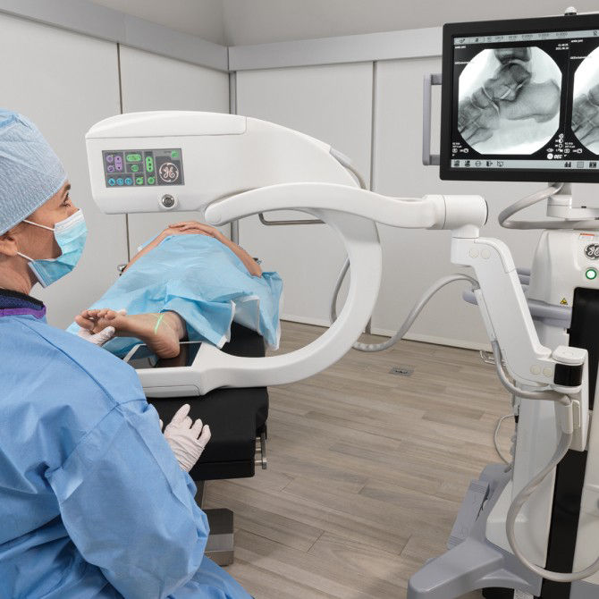 c-arms-for-orthopedic-extremities-surgery