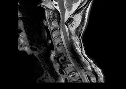 FairfaxSpineImaging-Desktop-516x680