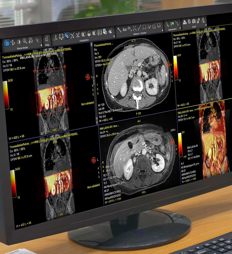 fast-efficient-feature-hero-desktop-ci-en