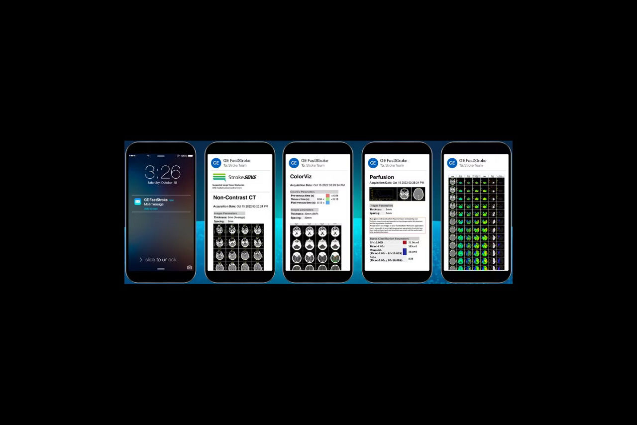faststroke-click-workflow-ph-en