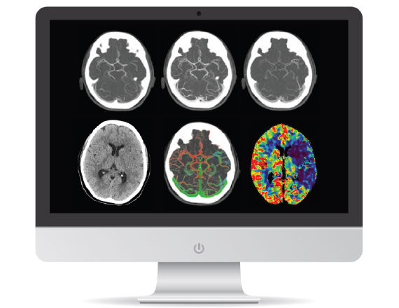<p>FastStroke CT Application</p>
