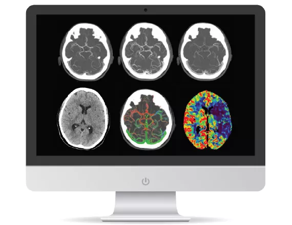 <p>FastStroke CT Application</p>
