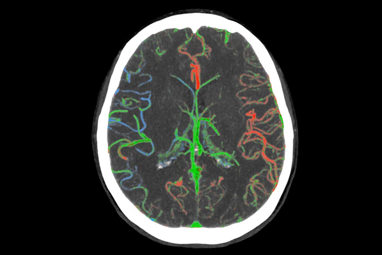 faststroke-interactive-workflow-ci-en
