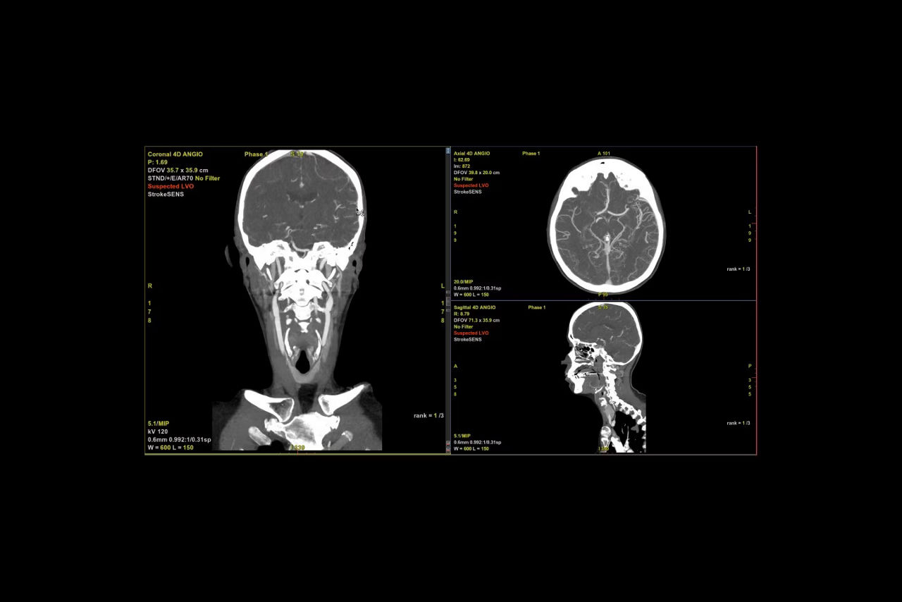 faststroke-seamless-integration-ci-en