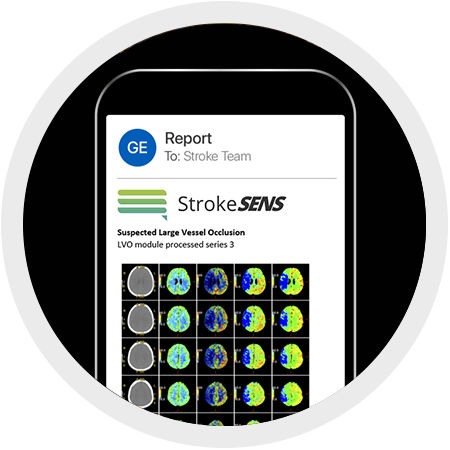 FastStroke_with_StrokeSens-LVO-fullwidth