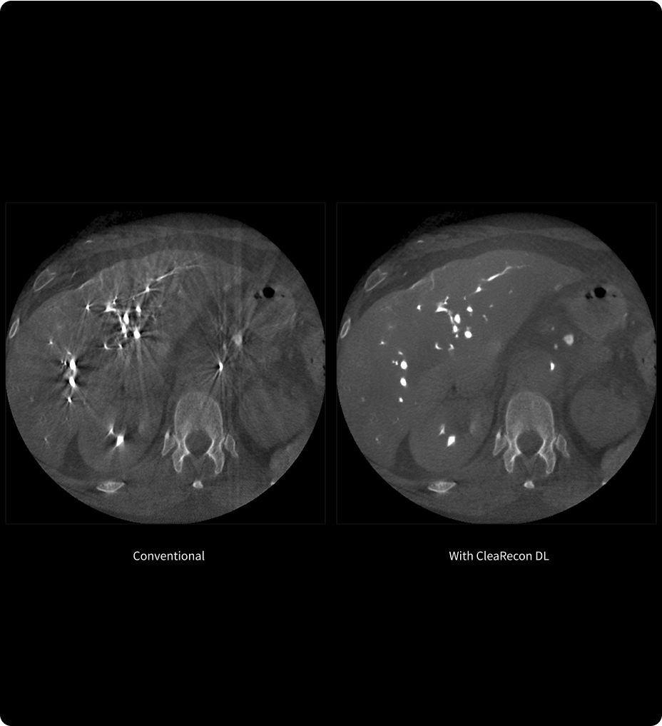 CleaRecon DL: AI-enhanced CBCT image quality for accurate diagnosis and treatment planning