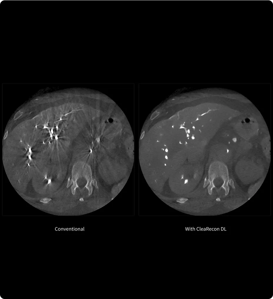 CleaRecon DL: AI-enhanced CBCT image quality for accurate diagnosis and treatment planning