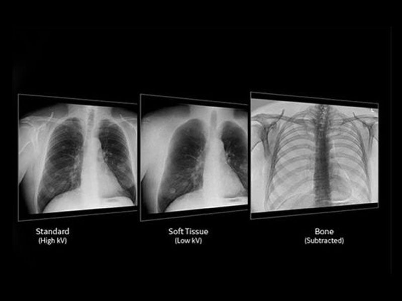 feature-card-11-ci-en