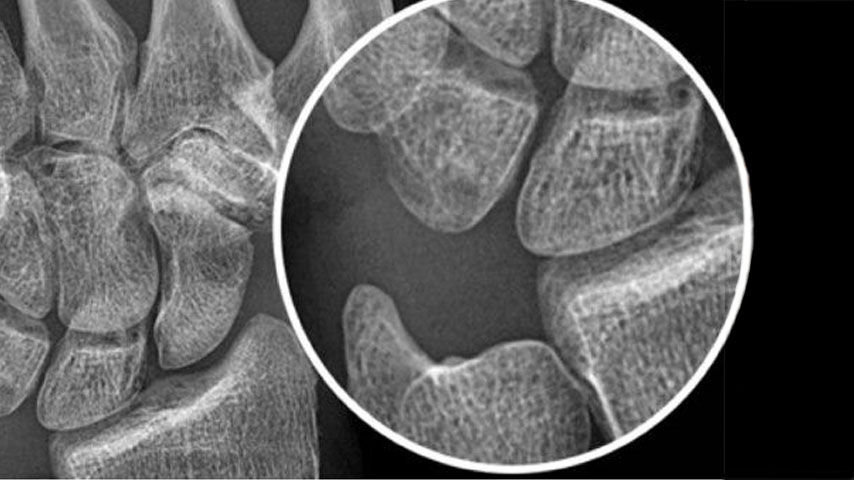 feature-card-12-ci-en