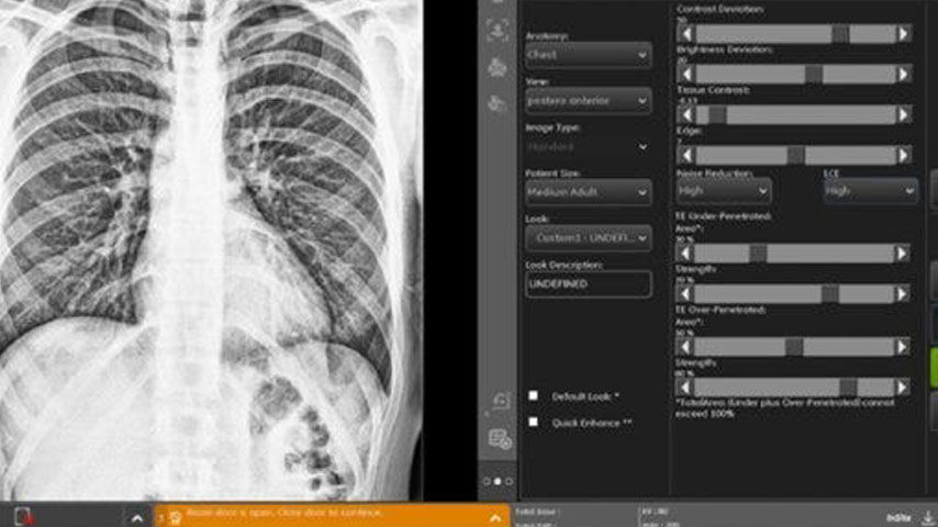 feature-card-13-ci-en