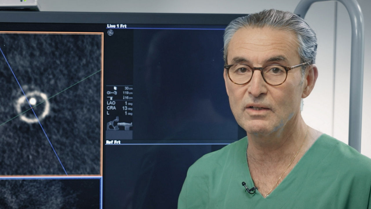 Feature-card-854x480-Benamet