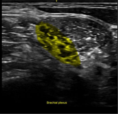 feature-card-ai-desktop1