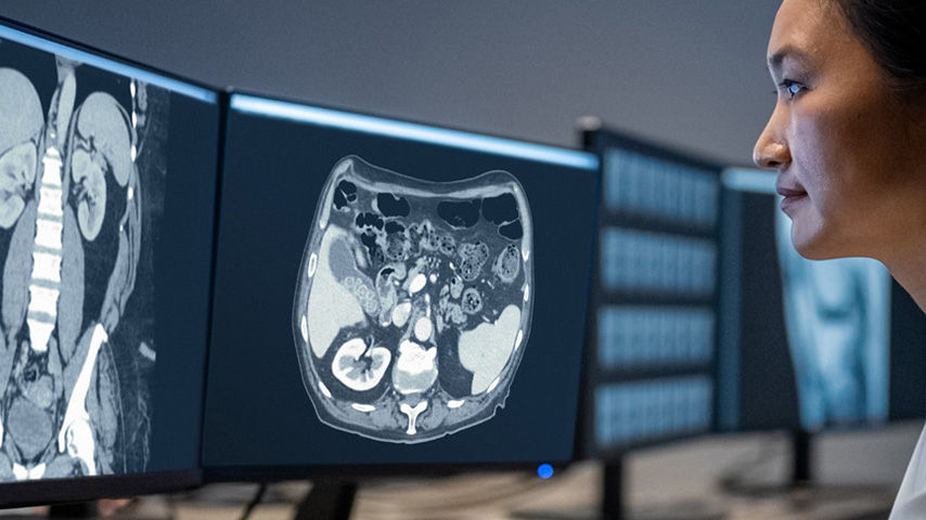 feature-card-true-fidelity-half-width