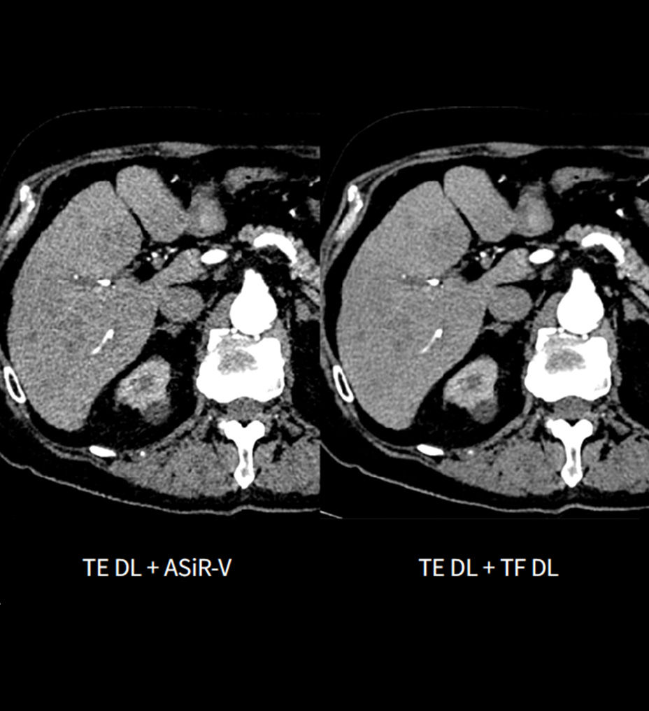 feature-hero-better-together-dl-desktop