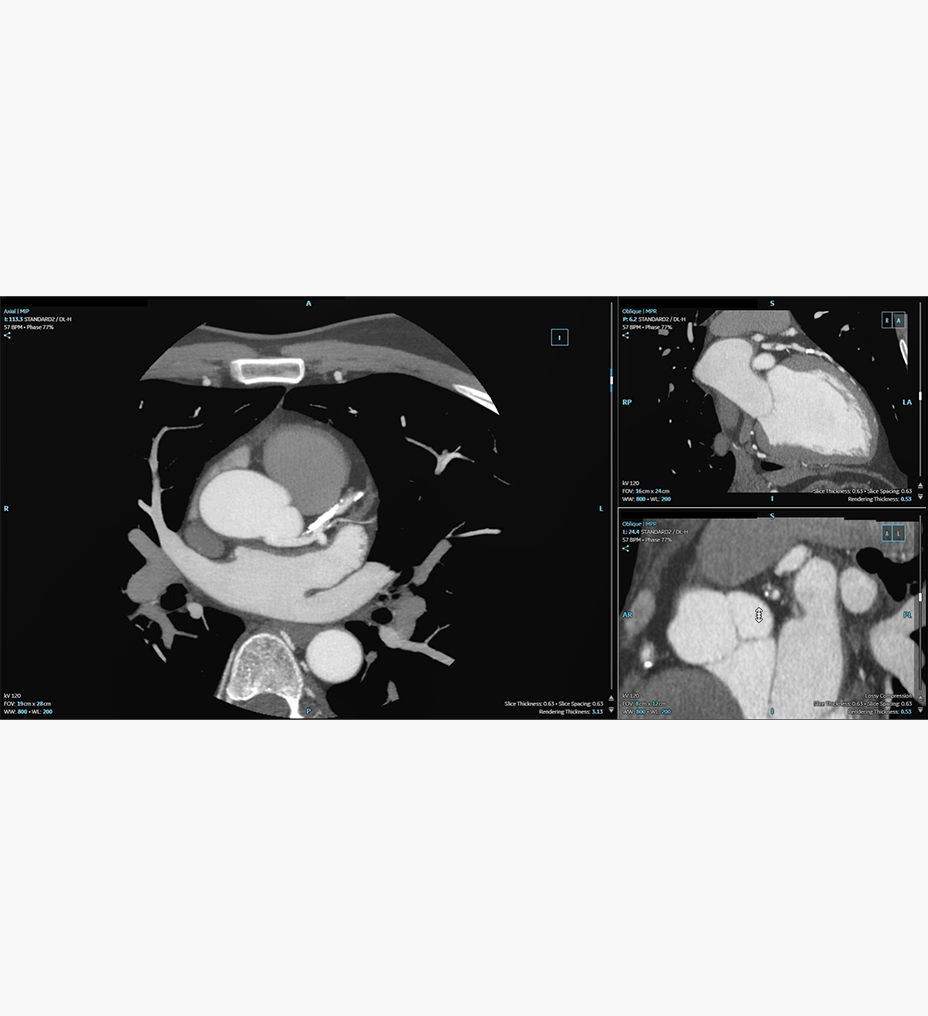 feature-hero-ccta-desktop