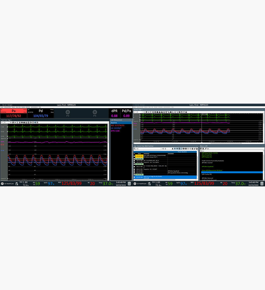 feature-hero-elevated-accuracy-desktop