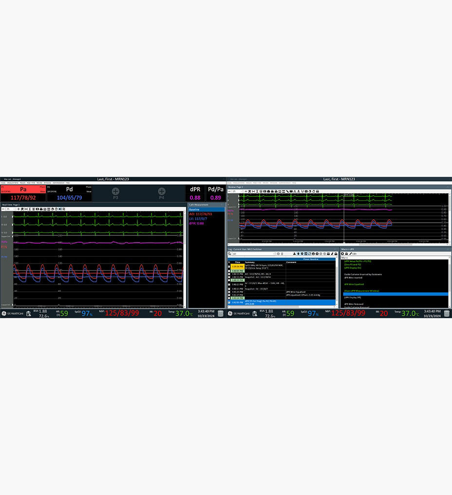 feature-hero-elevated-accuracy-desktop-ci-en