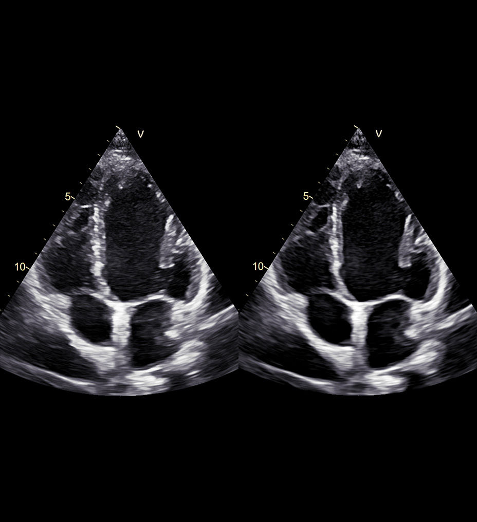 feature-hero-sharp-images-desktop