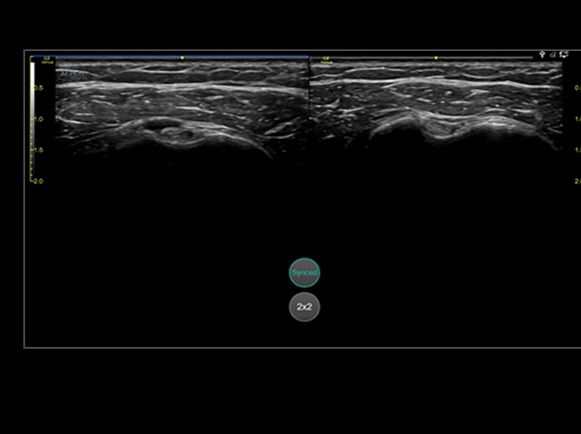 featurecard-follow-up-desktop1