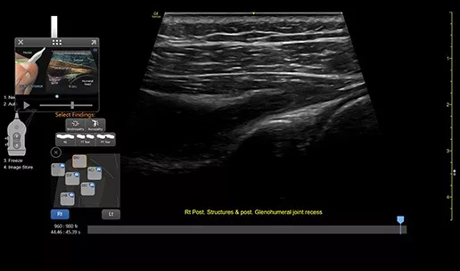 featurecard-l4-20t-rs-right-post-labrum-ghj-desktop1