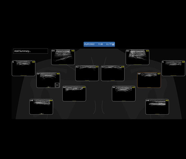 featurecard-L4-20t-RS-Shoulder-Diagram-desktop
