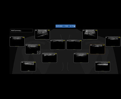 featurecard-L4-20t-RS-Shoulder-Diagram-tablet