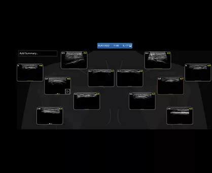 featurecard-L4-20t-RS-Shoulder-Diagram-tablet