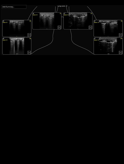 featurecard-Lung-Diagram-desktop