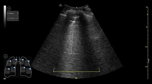 featurecard-lung-diagram-desktop