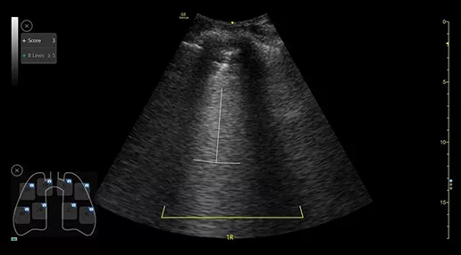 featurecard-lung-diagram-desktop