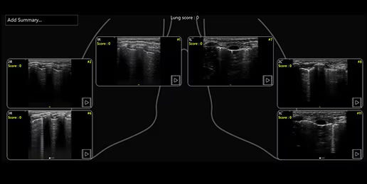 featurecard-lung-diagram-desktop