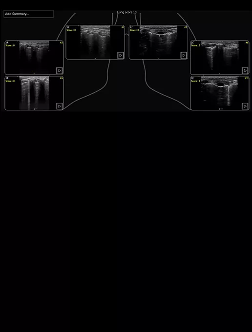 featurecard-Lung-Diagram-desktop