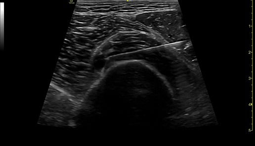 featurecard-needle-mode-desktop1