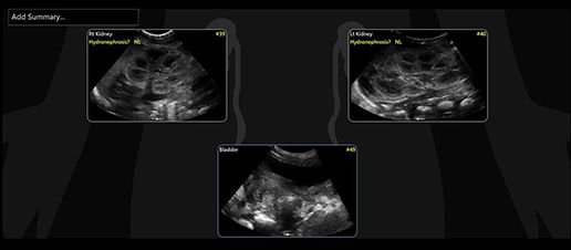 featurecard-renal-diagram-desktop