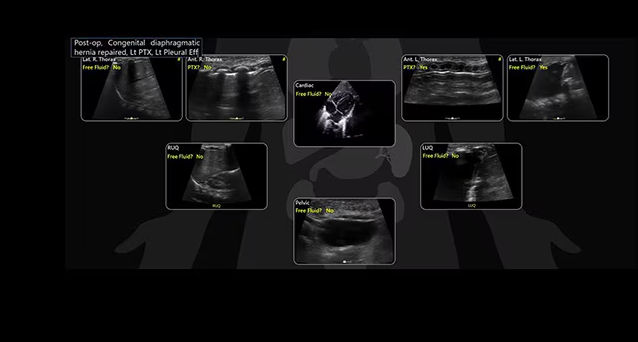 featurecards-efast-diagram-review-desktop