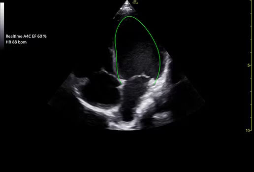 featurecards-real-time-ef-desktop