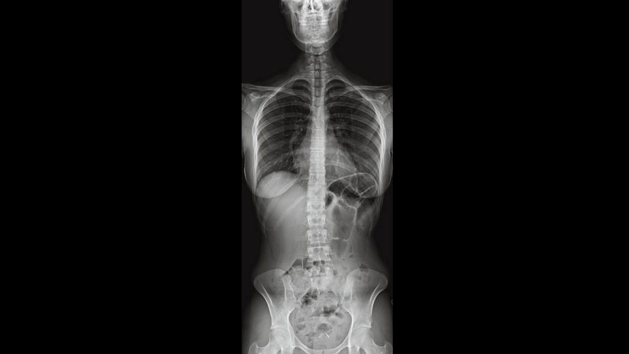 featured-applications-3-ci-en