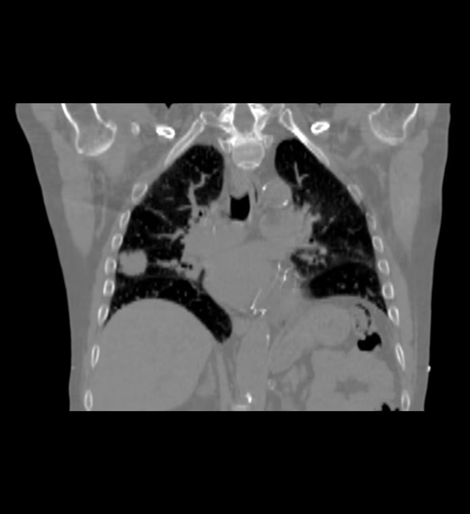 featured-hero-simplified-workflow-desktop