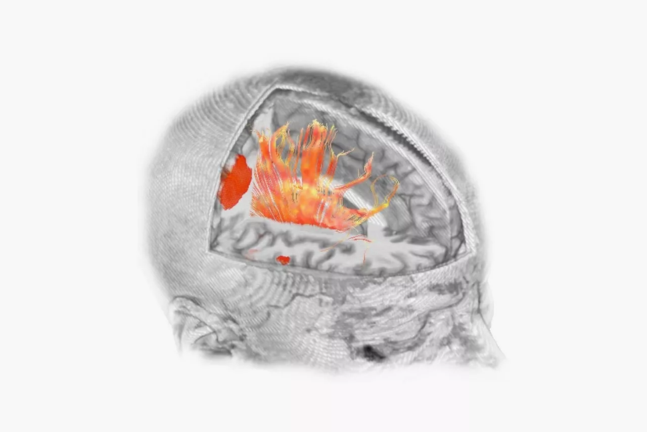 features-brainwave-imaging-ci-en
